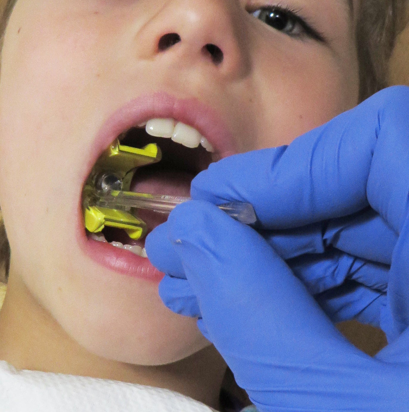 Bite Buddy Placement Pal