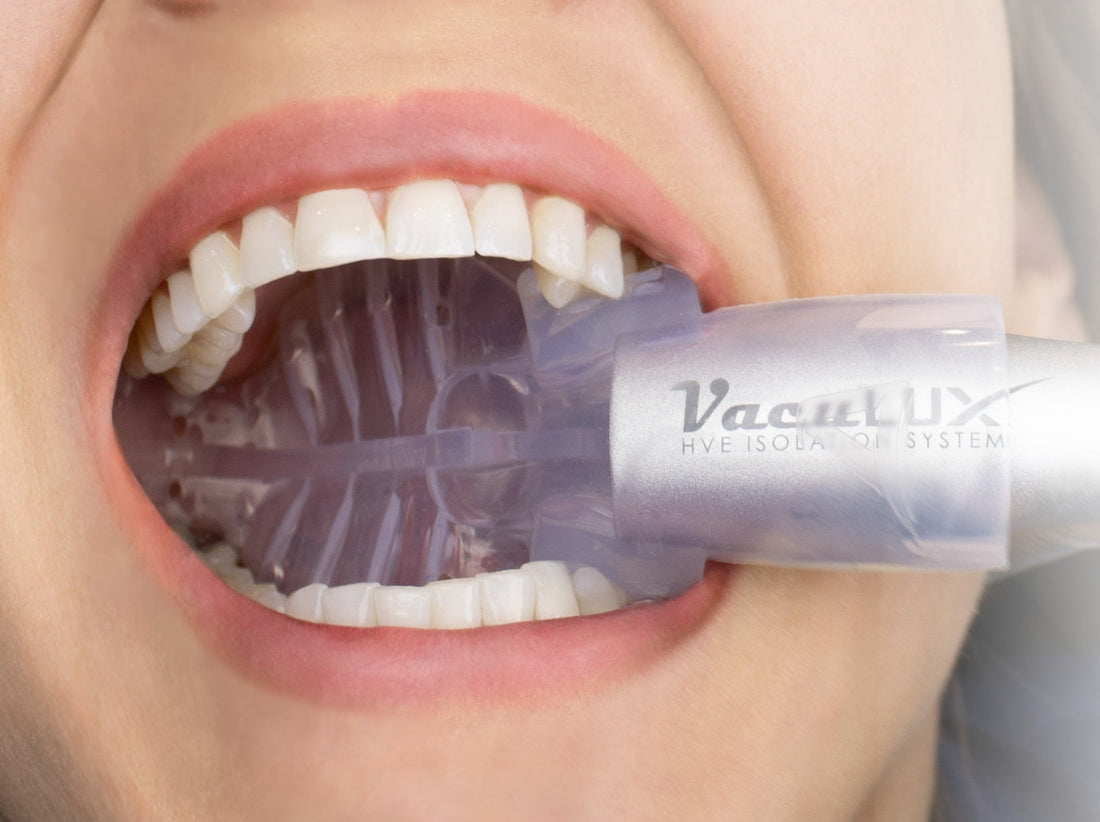 Get the Most from your VacuLUX Mouthpieces